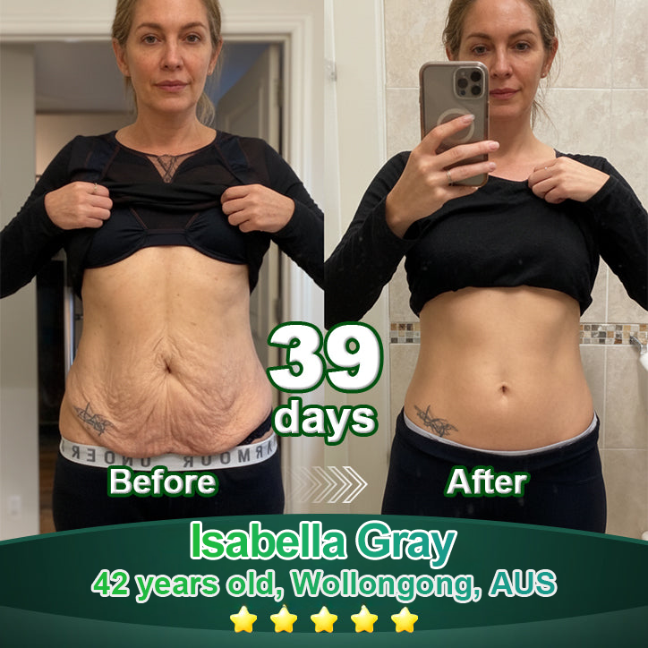 Enjoy 30% OFF for adding the second one🧡| Cvreoz®