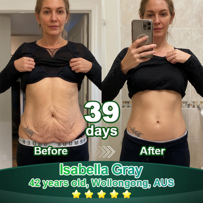 Enjoy 30% OFF for adding the second one🧡| Cvreoz®