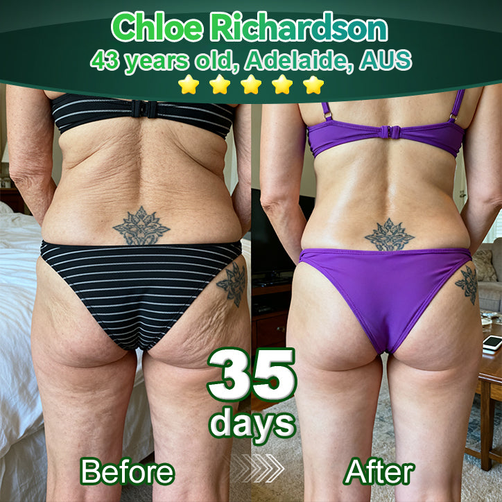 Enjoy 30% OFF for adding the second one🧡| Cvreoz®