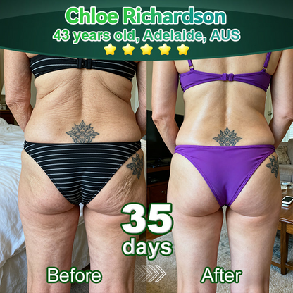 Enjoy 30% OFF for adding the second one🧡| Cvreoz®